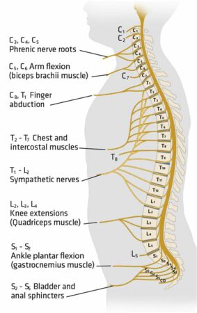 t6 spinal cord injury